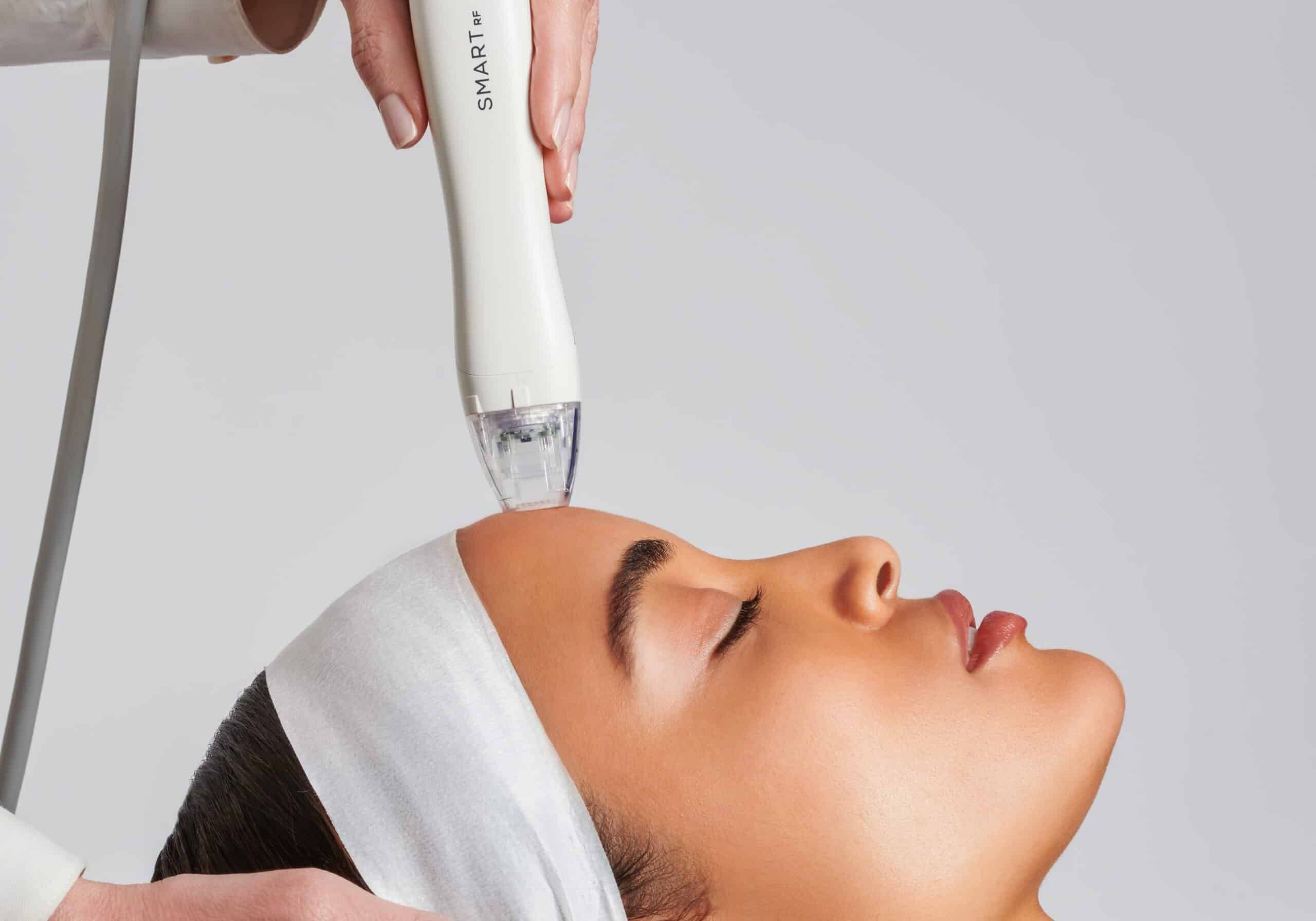 Virtue RF Microneedling at Boost Beauty Boutique in Columbia, IL near Waterloo IL near me